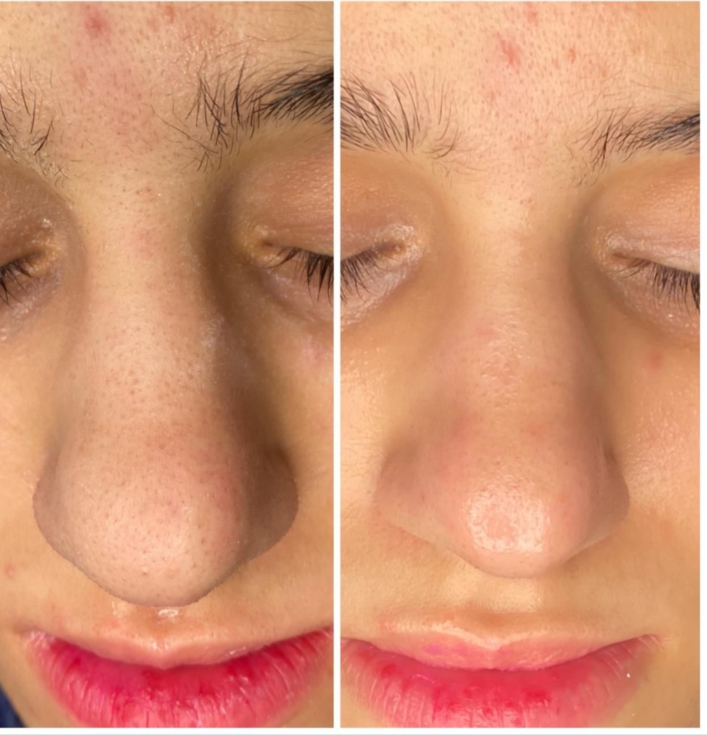 بالصور: تنظيف بشرة مع وفاء سمير