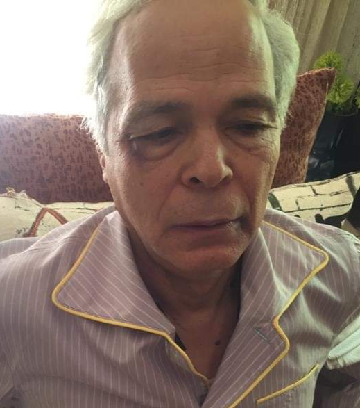 بالصور... علقة ساخنة للفنان محمود عامر بسبب "الحيطة"