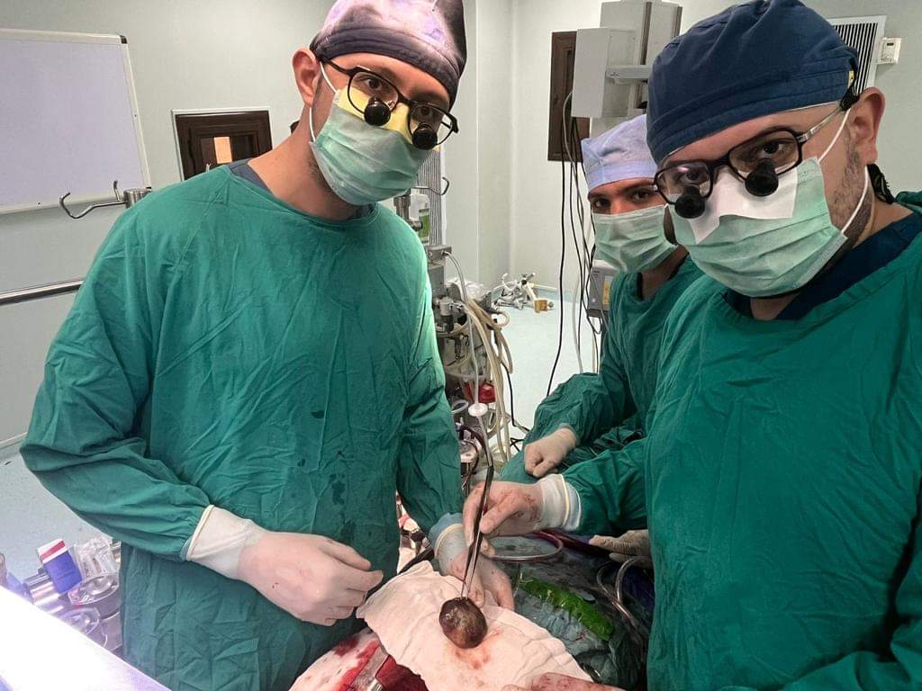 فريق طبى ينجح فى إنقاذ حياة سيدة أربعينية باستئصال ورم ضخم من القلب بأسيوط