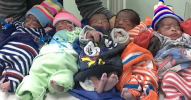 ولادة ناجحة لـ5 توائم 4 أولاد وأنثى بمستشفى جنوب الوادى الجامعى