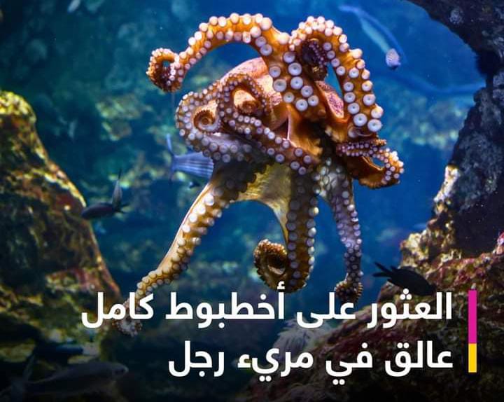 أطباء يعثرون على أخطبوط كامل في مريء رجل