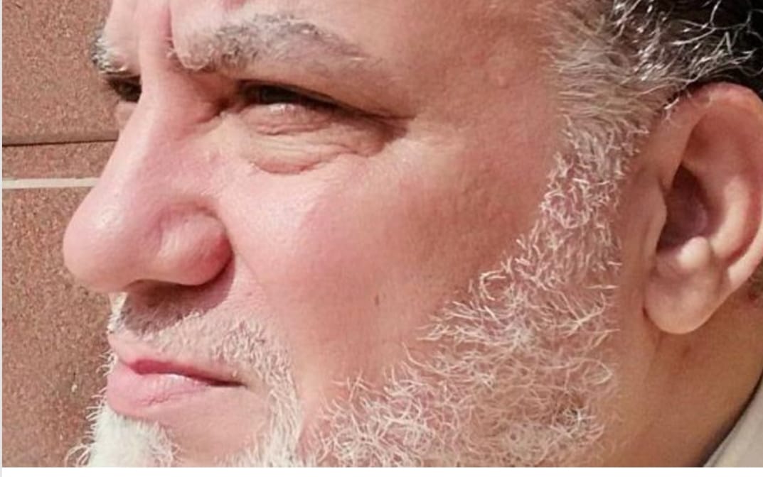 العالم كله فيكي