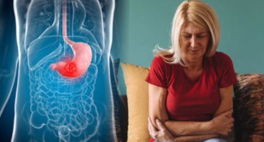 مرض إلتهاب الأمعاء...العلاج في تغيير نمط الحياة