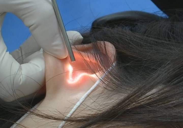 في واقعة غريبة.. قُبلة رومانسية تُمزِّق طبلة أذن فتاة