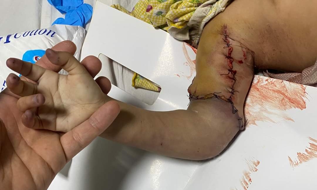 إنقاذ طفلة قطعت يدها في غسالة بسوهاج