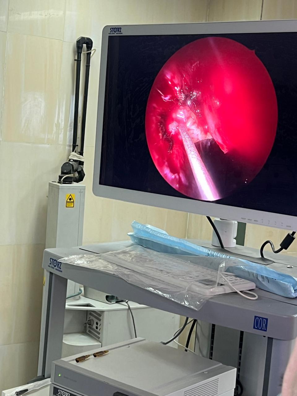 بالصور : مستشفي سوهاج الجامعي ينجح في اجراء عمليه رقع ورأب قاع الجمجمه