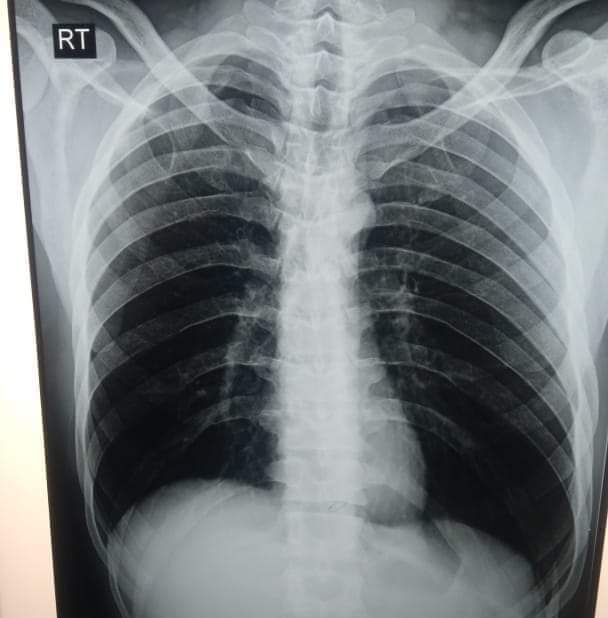 دكتور محمود الشناوي يكتب : أعرف عندك حساسية صدر أم لأ؟