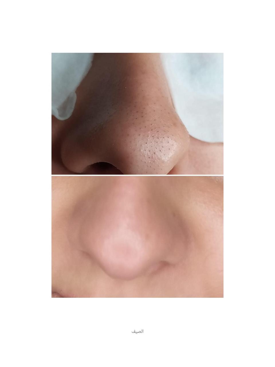 بالصور: تنظيف البشرة مع خبيرة التجميل وفاء سمير