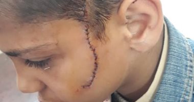 والد تلميذ المرج: المتهم شق وجه ابنى لدفاعه عن طالب يتيم